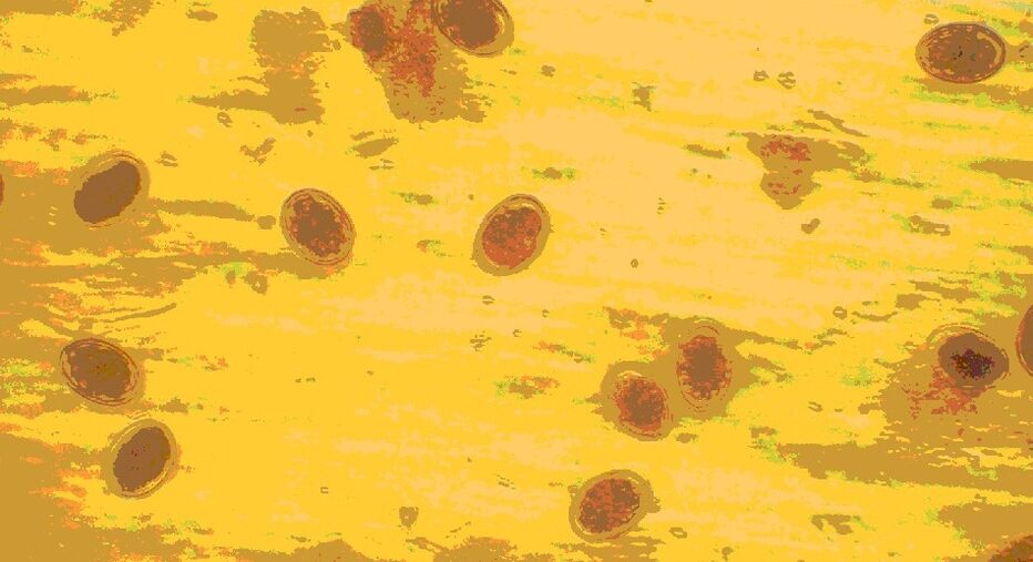 Würmer unter dem Mikroskop: Wie ihre Eier und Parasiten aussehen